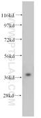 Peroxisomal Biogenesis Factor 16 antibody, 14816-1-AP, Proteintech Group, Western Blot image 