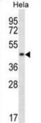 DnaJ Heat Shock Protein Family (Hsp40) Member A3 antibody, abx028275, Abbexa, Western Blot image 