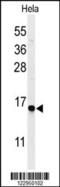 GABA Type A Receptor Associated Protein Like 1 antibody, 63-796, ProSci, Western Blot image 