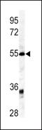 Growth Differentiation Factor 6 antibody, PA5-14394, Invitrogen Antibodies, Western Blot image 