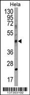 Chitinase Domain Containing 1 antibody, 58-975, ProSci, Western Blot image 