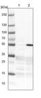 Zinc Finger And BTB Domain Containing 49 antibody, PA5-55081, Invitrogen Antibodies, Western Blot image 