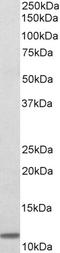 Beta-2-Microglobulin antibody, LS-C155011, Lifespan Biosciences, Western Blot image 