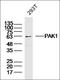 P21 (RAC1) Activated Kinase 1 antibody, orb101431, Biorbyt, Western Blot image 
