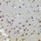 MYCN Proto-Oncogene, BHLH Transcription Factor antibody, 13-185, ProSci, Immunohistochemistry paraffin image 