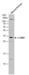 U6 snRNA-associated Sm-like protein LSm2 antibody, GTX130964, GeneTex, Western Blot image 