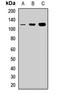 NOP14 Nucleolar Protein antibody, LS-C668467, Lifespan Biosciences, Western Blot image 