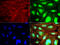 TNF Receptor Superfamily Member 18 antibody, LS-C796957, Lifespan Biosciences, Immunofluorescence image 