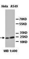 Aquaporin 2 antibody, orb77111, Biorbyt, Western Blot image 