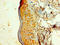Keratin 6A antibody, LS-C369891, Lifespan Biosciences, Immunohistochemistry paraffin image 