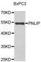 Pancreatic Lipase antibody, STJ29557, St John