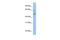 MSS51 Mitochondrial Translational Activator antibody, PA5-43561, Invitrogen Antibodies, Western Blot image 