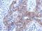Brevican antibody, NBP2-15616, Novus Biologicals, Immunohistochemistry frozen image 