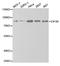 Eukaryotic Translation Initiation Factor 4B antibody, LS-C748357, Lifespan Biosciences, Western Blot image 