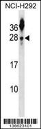 Tetraspanin 2 antibody, 58-762, ProSci, Western Blot image 