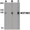 Stromal Interaction Molecule 2 antibody, PA5-20373, Invitrogen Antibodies, Western Blot image 