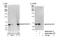Lysine Acetyltransferase 8 antibody, NB100-55251, Novus Biologicals, Western Blot image 