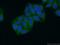 Cytochrome B5 Type B antibody, 15469-1-AP, Proteintech Group, Immunofluorescence image 