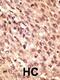 LDL Receptor Related Protein 5 antibody, 62-146, ProSci, Immunohistochemistry paraffin image 