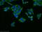 Ribosomal Protein L18a antibody, 14653-1-AP, Proteintech Group, Immunofluorescence image 