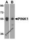 Serine/threonine-protein kinase PINK1, mitochondrial antibody, 7859, ProSci Inc, Western Blot image 