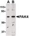 P21 (RAC1) Activated Kinase 4 antibody, PA5-20233, Invitrogen Antibodies, Western Blot image 