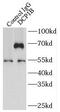 Decapping MRNA 1B antibody, FNab02270, FineTest, Immunoprecipitation image 