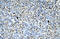 Asialoglycoprotein Receptor 2 antibody, ARP33821_T100, Aviva Systems Biology, Immunohistochemistry paraffin image 