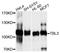 Transducin Beta Like 3 antibody, STJ112083, St John