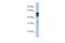 EGF Domain Specific O-Linked N-Acetylglucosamine Transferase antibody, A09267, Boster Biological Technology, Western Blot image 