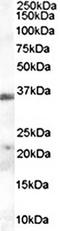 Hepatitis A Virus Cellular Receptor 2 antibody, orb19191, Biorbyt, Western Blot image 