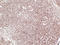 CD1a Molecule antibody, LS-C744461, Lifespan Biosciences, Immunohistochemistry frozen image 
