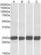 Growth Factor Receptor Bound Protein 2 antibody, NB100-866, Novus Biologicals, Western Blot image 