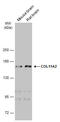 Collagen Type XI Alpha 2 Chain antibody, GTX629740, GeneTex, Western Blot image 