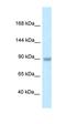 TBC1 Domain Family Member 2B antibody, orb324387, Biorbyt, Western Blot image 