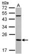 Ferritin Mitochondrial antibody, NBP2-14961, Novus Biologicals, Western Blot image 