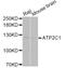 ATPase Secretory Pathway Ca2+ Transporting 1 antibody, A2515, ABclonal Technology, Western Blot image 