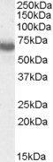 IKAROS Family Zinc Finger 1 antibody, PA5-18735, Invitrogen Antibodies, Western Blot image 
