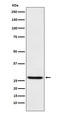 Eukaryotic Translation Initiation Factor 4E antibody, M00135, Boster Biological Technology, Western Blot image 