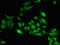 SET Domain Containing 5 antibody, LS-C398443, Lifespan Biosciences, Immunofluorescence image 
