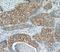 EGFR antibody, FNab02667, FineTest, Immunohistochemistry frozen image 