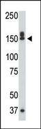 Death Associated Protein Kinase 1 antibody, 62-737, ProSci, Western Blot image 