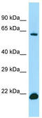Interferon Regulatory Factor 2 Binding Protein 2 antibody, TA331331, Origene, Western Blot image 