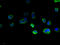TBC1 Domain Family Member 20 antibody, A61238-100, Epigentek, Immunofluorescence image 