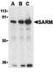 Sterile Alpha And TIR Motif Containing 1 antibody, orb74542, Biorbyt, Western Blot image 