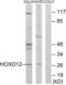 Homeobox D12 antibody, LS-C118870, Lifespan Biosciences, Western Blot image 