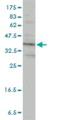 Protein Activator Of Interferon Induced Protein Kinase EIF2AK2 antibody, H00008575-M01, Novus Biologicals, Western Blot image 