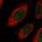 Centromere Protein N antibody, NBP2-55538, Novus Biologicals, Immunofluorescence image 