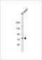 CT-1 antibody, 61-302, ProSci, Western Blot image 