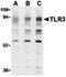 Toll Like Receptor 3 antibody, PA5-20184, Invitrogen Antibodies, Western Blot image 